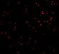 IRE1p Antibody